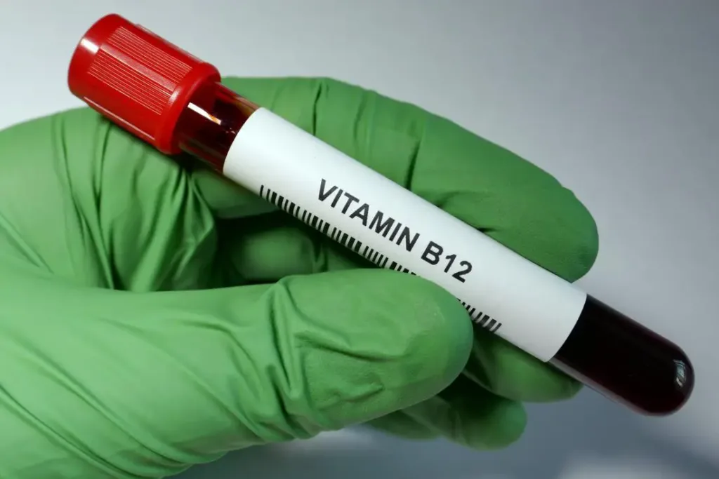 Vitamin B12 Test Kothrud Pune